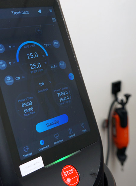 A close up of the laser machine at Mitchell Wachtel, DPM.