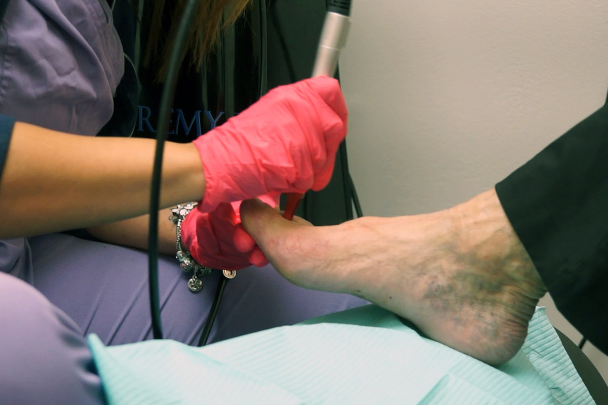 A podiatry specialist uses laser therapy to help with skin and nail health.