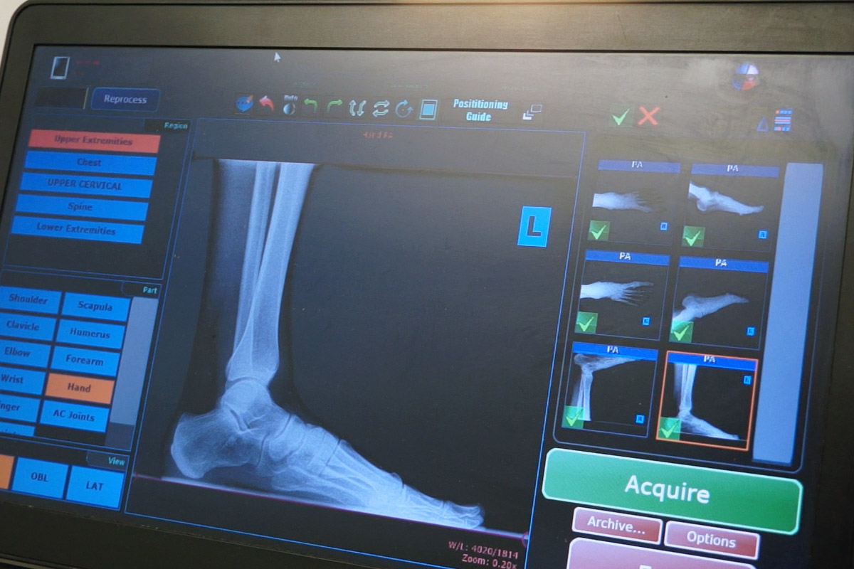 An x-ray screen reveals where the athlete is injured.