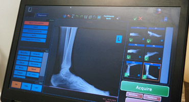 An athlete is getting an X-ray of the foot.